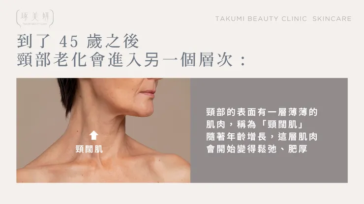 擺脫「火雞脖」！肉毒桿菌如何放鬆頸闊肌，重塑緊緻頸部線條