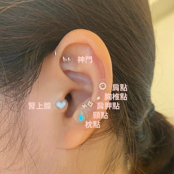 耳穴貼穴道-肩頸痠痛耳穴