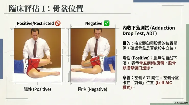 內收下降測試 (Adduction Drop Test, ADT)