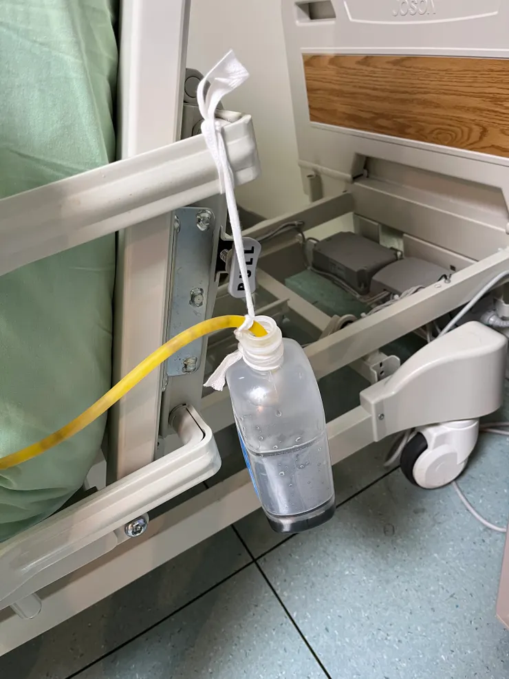 鼻胃管引流出的膽汁