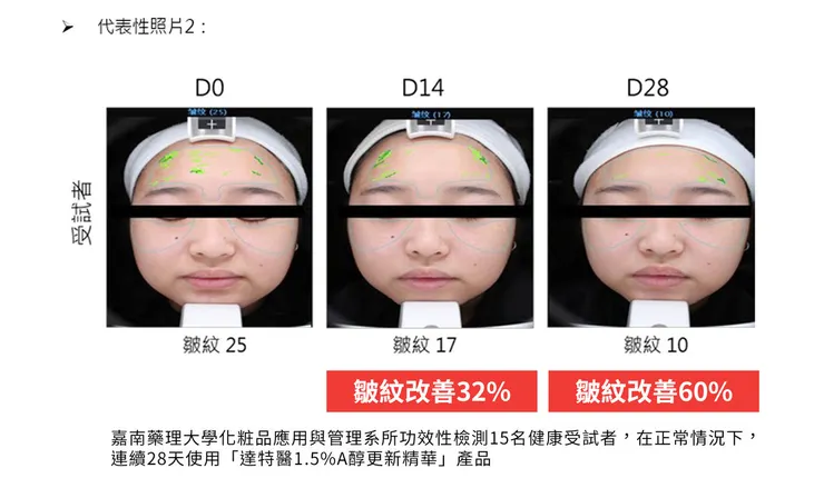 「A醇」現代抗老神器！