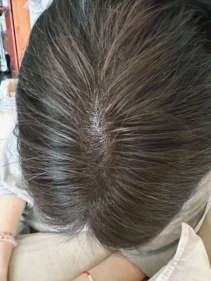 大範圍噴灑後髮縫差好多