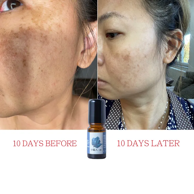 8矮人脈輪油。小靛人，使用前後比照圖。