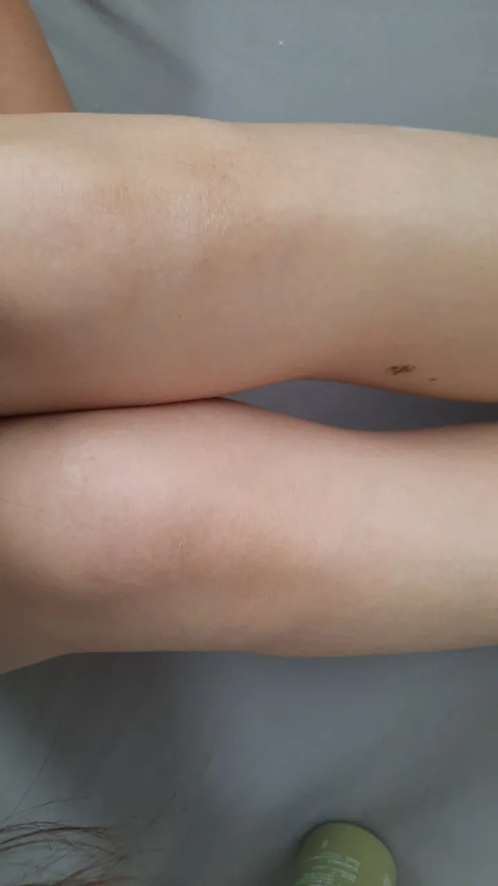 左腳膝蓋有擦乳液、右腳膝蓋沒擦乳液