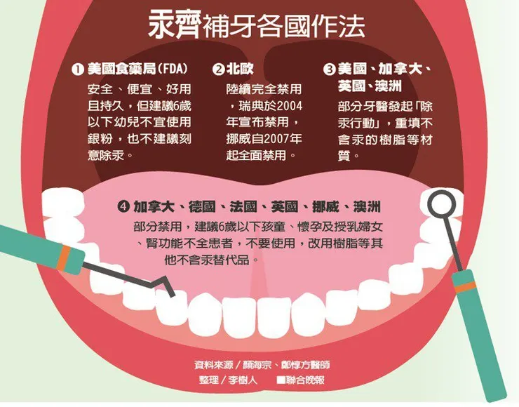 銀粉補牙各國作法