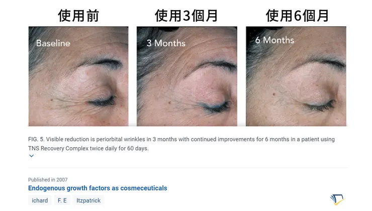 眼周保養成分怎麼選？