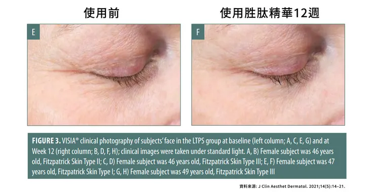 眼周保養成分怎麼選？