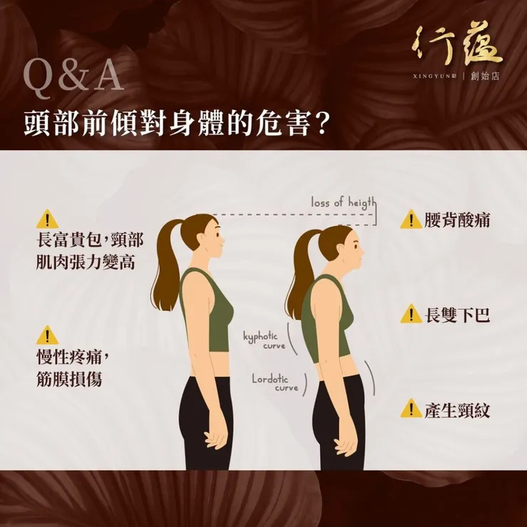 行蘊QA｜頭部前傾對身體的危害