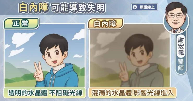 白內障可能導致失明