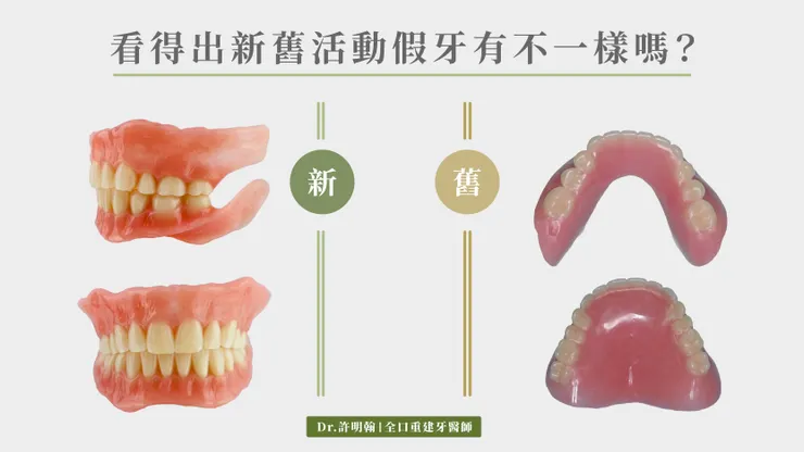 看得出新舊活動假牙哪裡不一樣嗎?