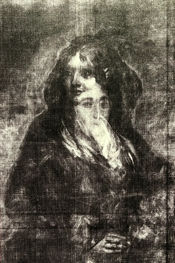 X光照射下所呈現的影像