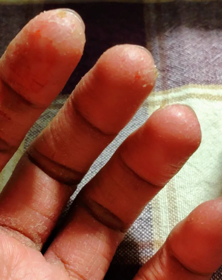 乾裂粗糙的指紋