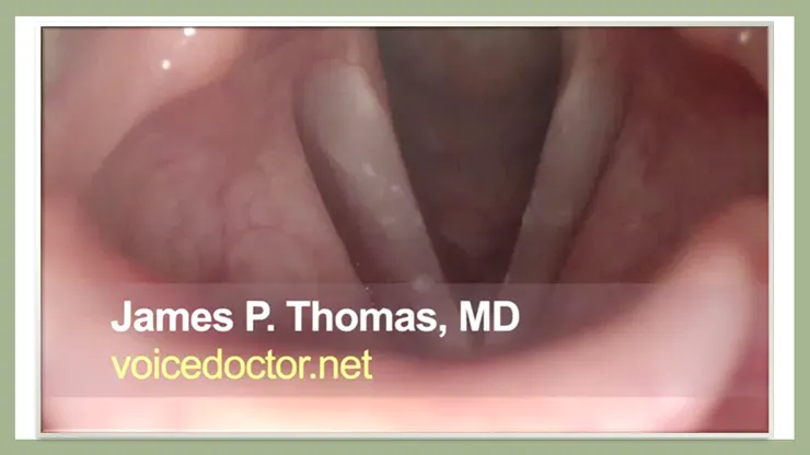 內視鏡下的聲帶動態