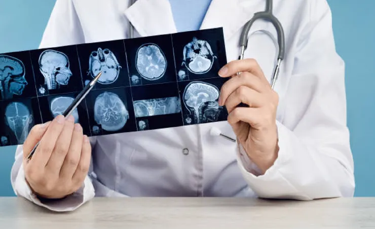 特別護士_腦動脈瘤