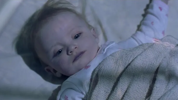 藍嬰症皮膚會呈現藍紫色