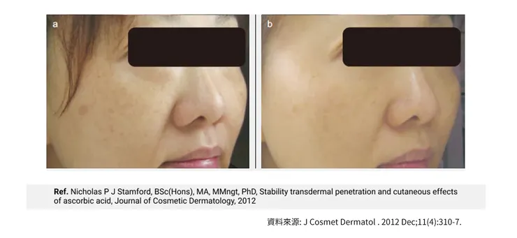 早C晚A 誰重要？兩大時機深入挑戰「早C好處」的保養計畫