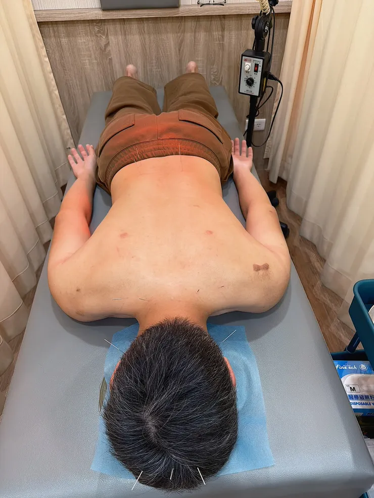 紅外線熱敷能促進局部血液循環，加強針灸後的放鬆效果。