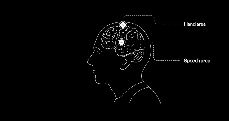 Telepathy 心電感應