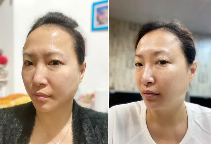 美容儀推薦│ZIIP HALO 好萊塢名人加持「掌上型」奈米微電流智能美膚管家