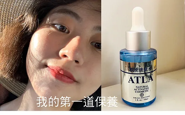 為什麼出國/旅行必長痘痘、口罩痘、消痘疤、下巴痘、人中痘、額頭痘、生理痘最有感精華液