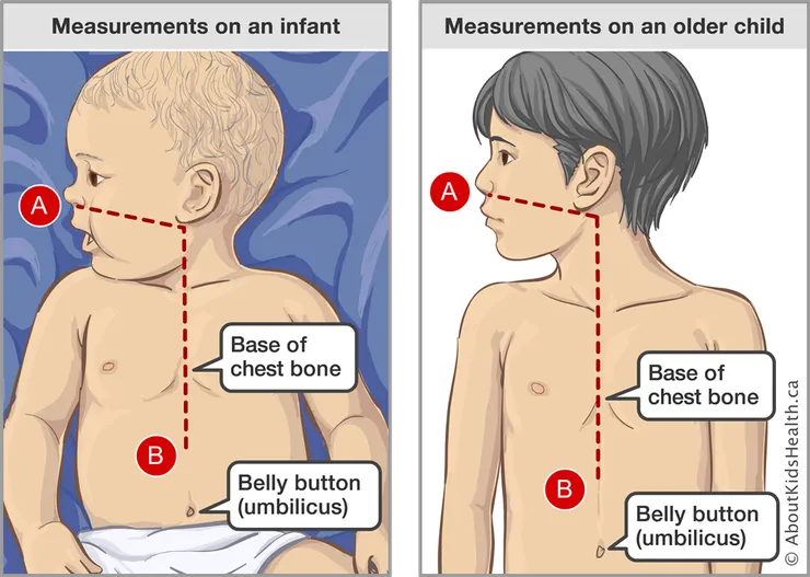 Source：AboutKidsHealth