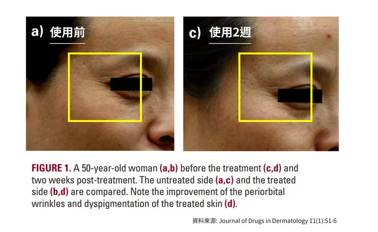 早C晚A 誰重要？兩大時機深入挑戰「早C好處」的保養計畫