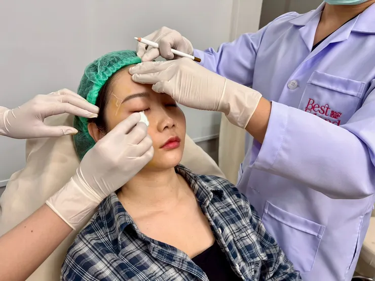 泰國曼谷醫美體驗|曼谷音波拉提推薦?泰國醫美諮詢流程與中文服務心得Best Friend Clinic