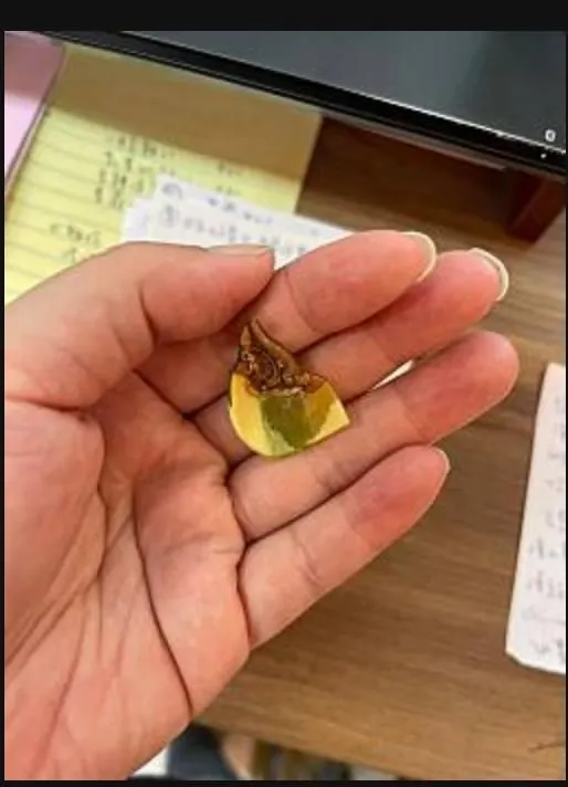 截肢手術還要拍照證明，真的傷口蔓延才動刀的