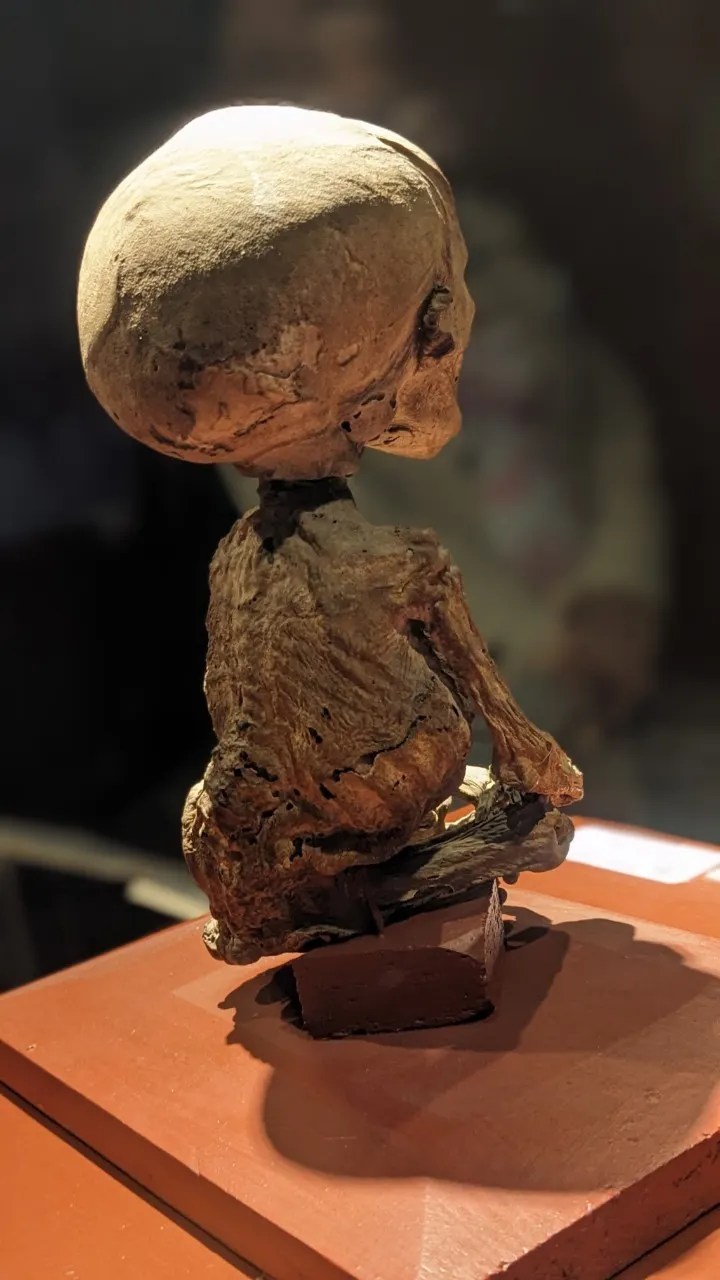 跟難產的媽媽一起死去的胎兒