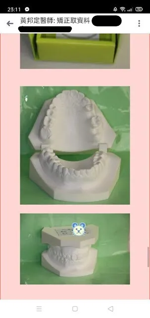 之後可精緻做成漂亮牙模，跟原始石膏模差很多吧
