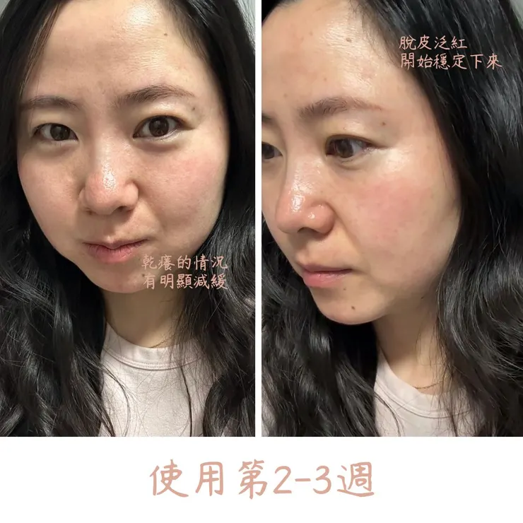 40歲敏感肌精華液使用對比