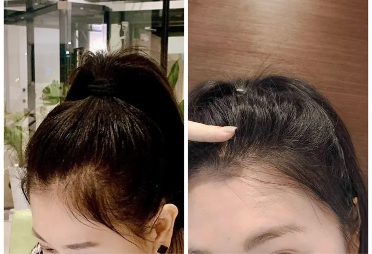 耶~長出來了耶😙