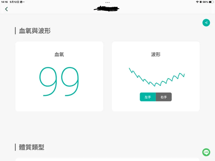 圖三：心波怪異血氧特高（不正常）
