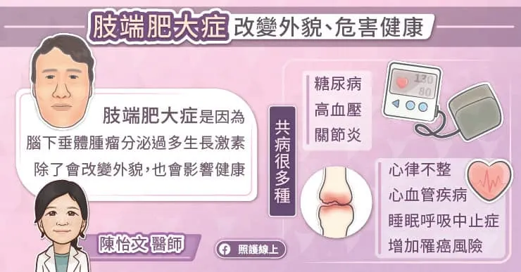 肢端肥大症改變外貌、危害健康