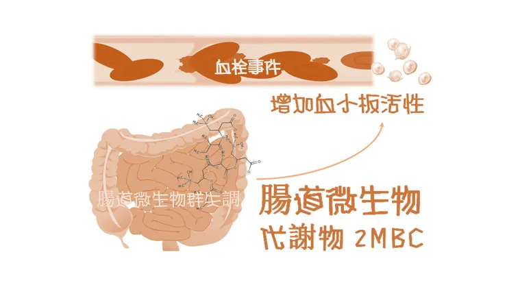 腸道微生物代謝物2MBC的血栓事件