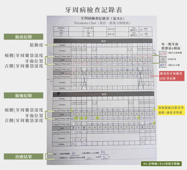 牙周病檢查記錄表（一）