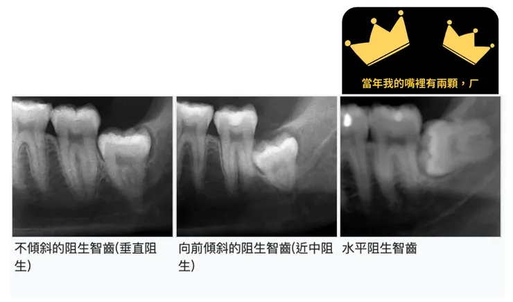 圖片原出處：維基百ㄎ