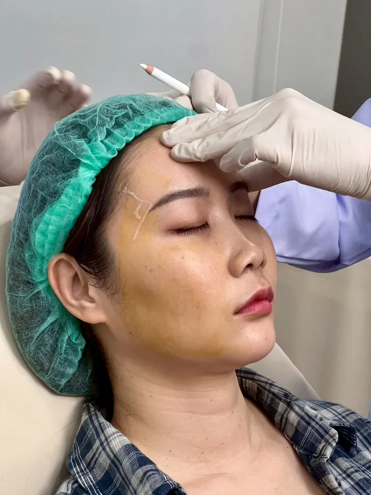 泰國曼谷醫美體驗|曼谷音波拉提推薦?泰國醫美諮詢流程與中文服務心得Best Friend Clinic