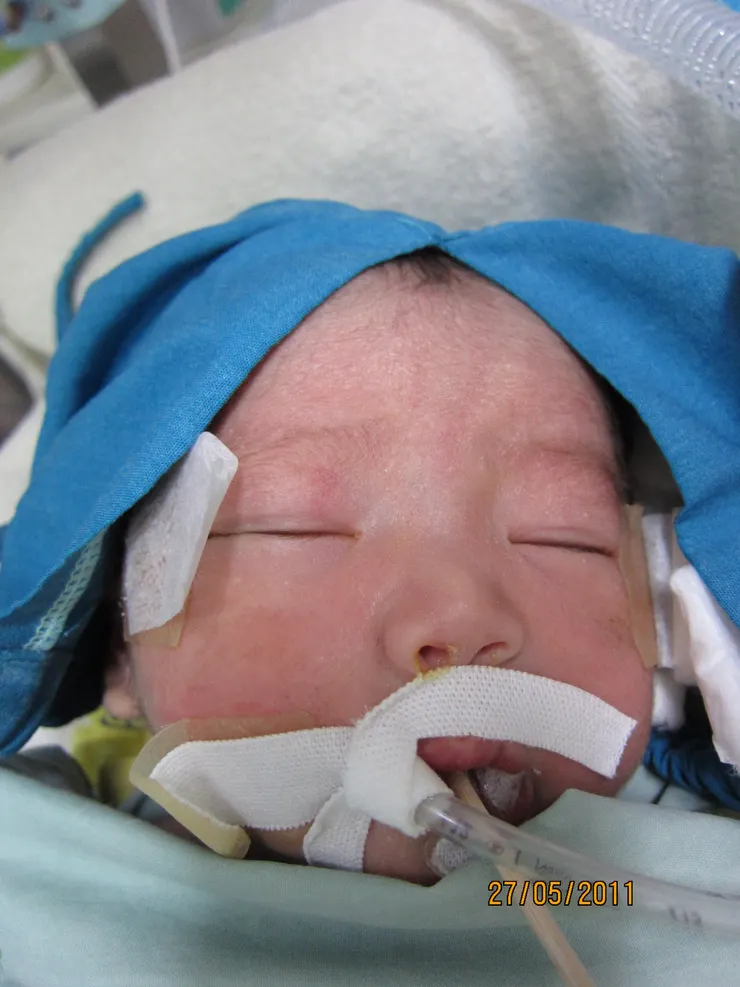 孩子用這種方式出生，一點都不容易。希望同溫層的家長們找到力量。