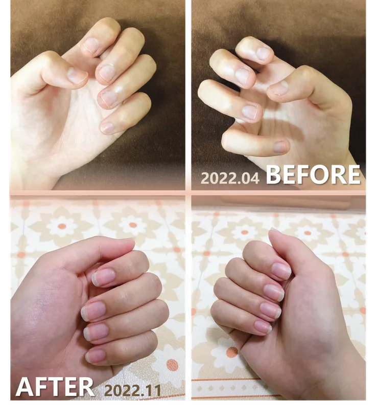 養甲半年對比照