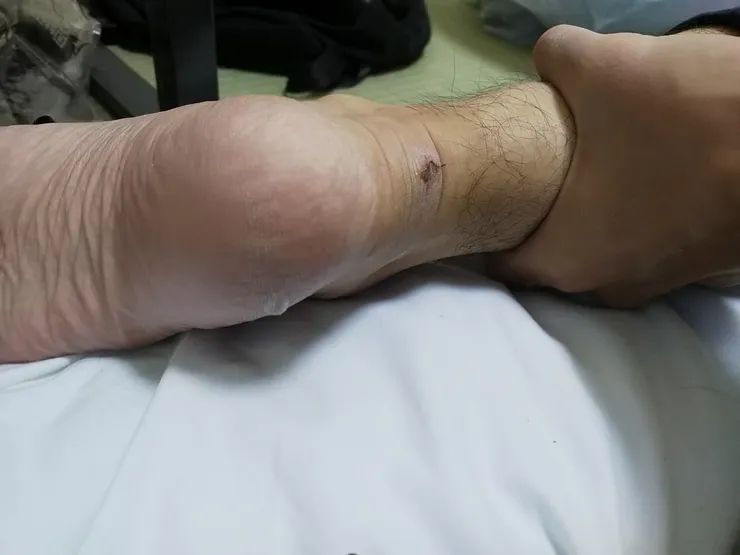 本想上個「殘破不堪」的圖說 但看起來還好嘛(?