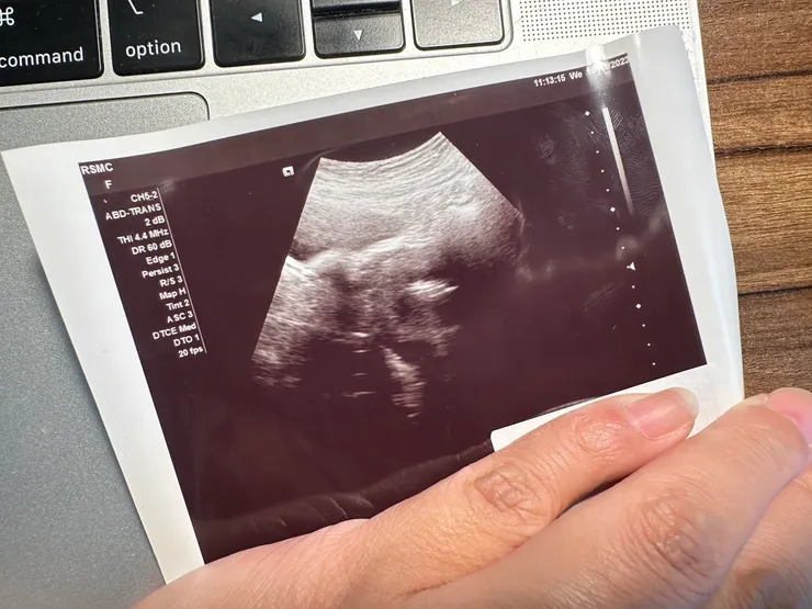 歡迎妳們加入我們的世界