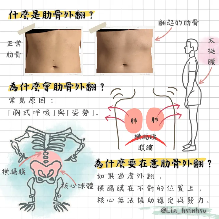肋骨外翻的原因與影響