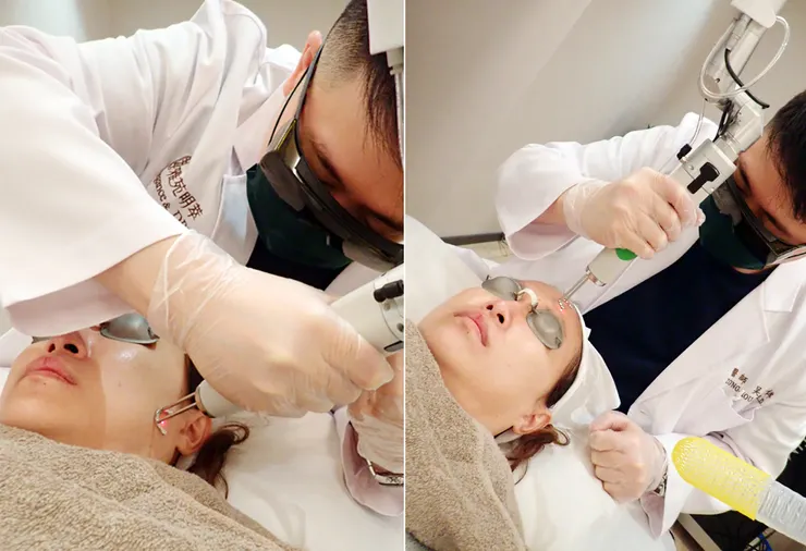 台北打皮秒│探索皮秒+蜂巢(超級鏡片ReFIX)-台北醫美診所推薦