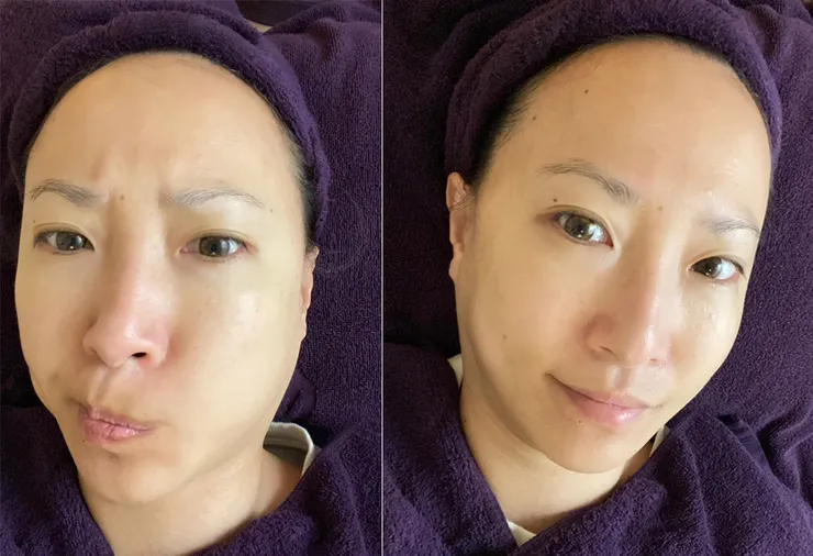 板橋美容去角質保養推薦│芮薇荷夢幻森林spa-板橋館│水飛梭氫水儀