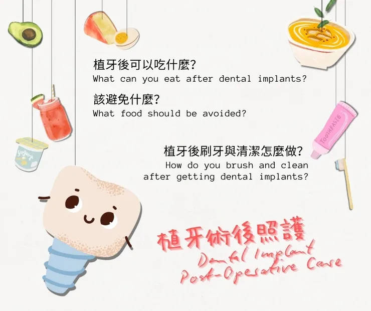 【植牙術後照護懶人包】吃什麼?不能吃什麼?怎麼清潔?一次搞懂術後保養重點!
