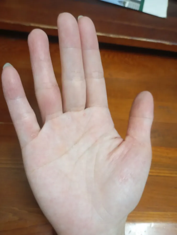 充滿印記的右手