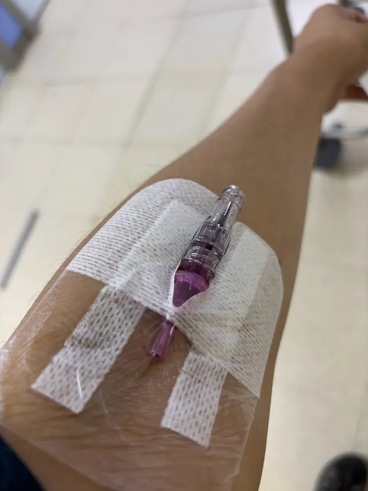 這個滯留針，真讓我無言。