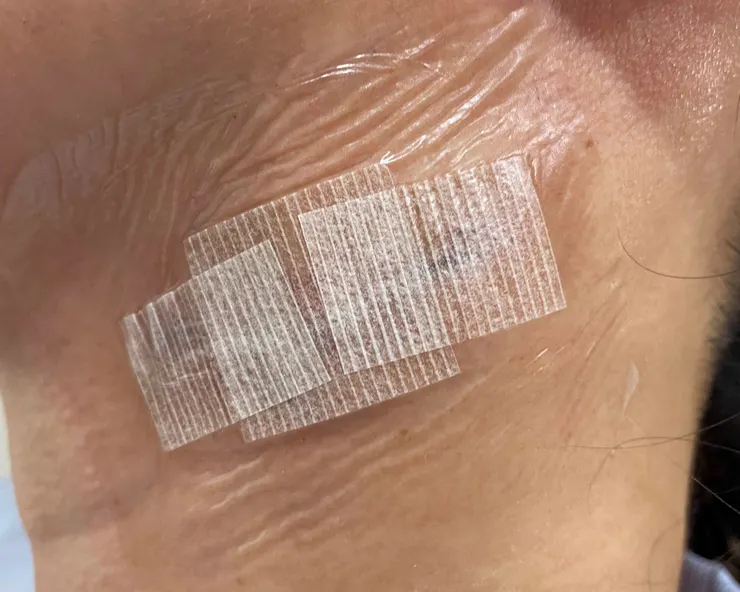 美容膠帶貼好貼滿