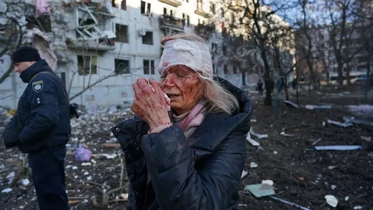 乌克兰舞蹈教师叶莲娜·库里洛因炮弹负伤